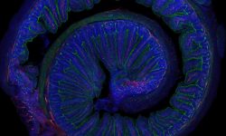 Microfotografía del intestino de un ratón adulto. Un reciente estudio conecta la microbiota intestinal con los beneficios del ejercicio físico moderado. Imagen: Elisa Cintado y José Luis Trejo (CNC-CSIC)