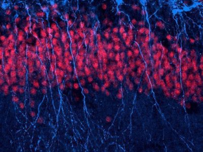 neuronas rompen su ADN