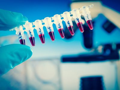 La PCR es una técnica de análisis molecular ampliamente utilizada