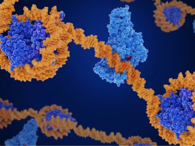 La alteración de las histonas afecta a la estabilidad genómica y está relacionada con el desarrollo de cáncer como la leucemia mieloide.