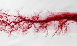 La arteritis de células gigantes afecta principalmente a arterias de gran y mediano calibre, como las que irrigan la cabeza y el cuello