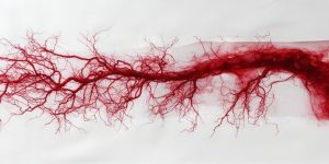 La arteritis de células gigantes afecta principalmente a arterias de gran y mediano calibre, como las que irrigan la cabeza y el cuello