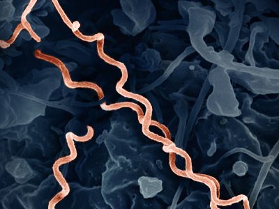 La metagenómica mejorará el diagnostico de infecciones difíciles de diagnosticar. Imagen: Micrografía electrónica coloreada de Treponema pallidum bacteria que produce sífilis. Si la bacteria llega al cerebro puede causar neurosífilis. Fuente: NIAID.