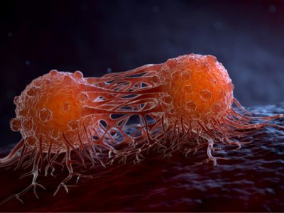 La oncología de precisión aborda el diagnóstico y tratamiento del cáncer a partir de las características del tumor y del paciente