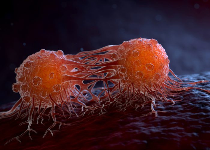 La oncología de precisión aborda el diagnóstico y tratamiento del cáncer a partir de las características del tumor y del paciente