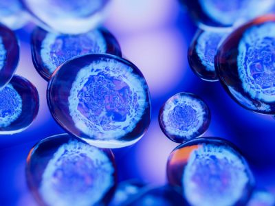 Las biopsias líquidas permiten analizar células tumorales circulantes o ADN tumoral libre en diferentes fluidos, como la orina, en el caso del cáncer de vejiga.