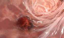 Los trabajos sobre las características del cáncer han permitido conocer mejor su formación y crecimiento.