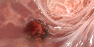 Los trabajos sobre las características del cáncer han permitido conocer mejor su formación y crecimiento.