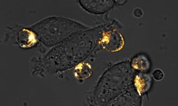Imagen microscópica de las células CAR-T modificadas genéticamente atacando a células de cáncer de mama marcadas. Imagen: Rosa Vincent y Thomas Savage.