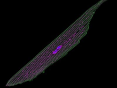 Imagen que muestra una célula muscular cardíaca de un ratón tratado con la nueva terapia génica. En magenta se muestran los nuevos canales iónicos de sodio sintetizados después de la introducción de los genes bacterianos modificados. Imagen: Tianyu Wu, Duke University
