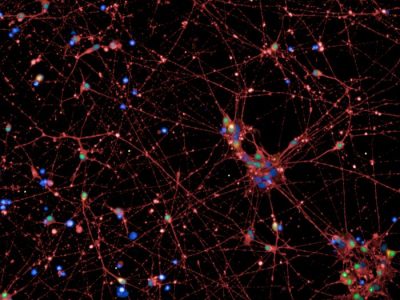 Imagen: Neuronas producidas de células madre humanas (en rojo y verde). El gen POMC es activo en las células marcadas en naranja y en azul se muestran los núcleos celulares. Imagen: © Charité, Lara Lechner.