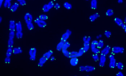Telómeros en verde y ADN en azul, durante la reparación del ADN. Salk Institute