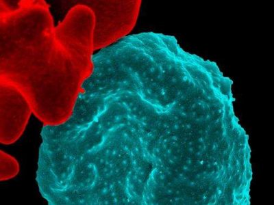 Glóbulo rojo infectado por malaria. Imagen: National Institutes of Health (NIH).