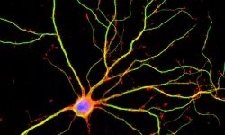 Neurona madura. Imagen: Shelley Halpain, UC San Diego.