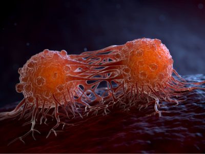 Mecanismo de resistencia a inmunoterapia en cáncer colorrectal