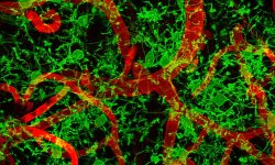 Microglia rodeando los vasos sanguíneos cerebrales en ratón anestesiado. Imagen: Harris A. Gelbard. University of Rochester Medical Center, Center for Neural Development and Disease Rochester, NY, USA.