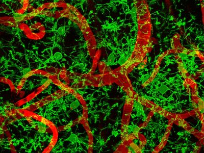 Microglia rodeando los vasos sanguíneos cerebrales en ratón anestesiado. Imagen: Harris A. Gelbard. University of Rochester Medical Center, Center for Neural Development and Disease Rochester, NY, USA.