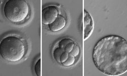 Secuencia de imágenes que muestra el desarrollo de embriones después de la inyección del sistema de edición génica y esperma de un donante con una mutación genética en el gen MYBPC conocida por causar cardiomiopatía hipertrófica. Imagen:  Oregon Health Science University.