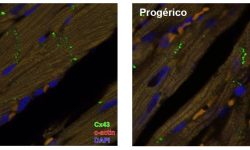 El estudio publicado en PNAS demuestra una localización incorrecta de la conexina 43 en las células del corazón progérico, concretamente lateralización y acumulación en la región perinuclear del citoplasma celular. Imagen cortesía de Jose Rivera, CNIC.