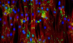 Células musculares cardíacas de ratón (Jesus Isaac Luna, Kara McCloskey lab, University of California, Merced, via California Institute for Regenerative Medicine)