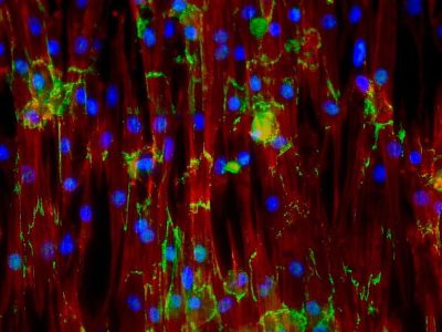 Células musculares cardíacas de ratón (Jesus Isaac Luna, Kara McCloskey lab, University of California, Merced, via California Institute for Regenerative Medicine)