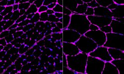 Los investigadores consiguieren mejorar el crecimiento de fibras musculares en ratones tratados con CRISPR para modificar el epigenoma (derecha)  respecto a ratones control (izquierda). Imágenes de fibras musculares de ratones mostrando la presencia de glicoproteína laminina. Imagen: Salk Institute.