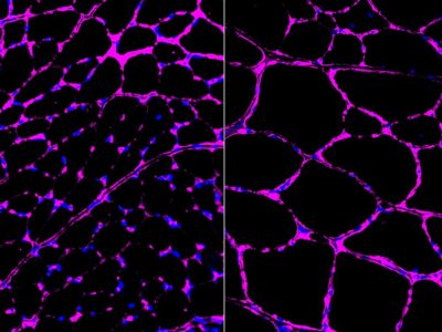 Los investigadores consiguieren mejorar el crecimiento de fibras musculares en ratones tratados con CRISPR para modificar el epigenoma (derecha)  respecto a ratones control (izquierda). Imágenes de fibras musculares de ratones mostrando la presencia de glicoproteína laminina. Imagen: Salk Institute.