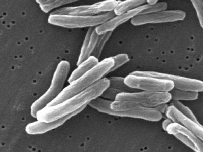 Mycobacterium tuberculosis. Imagen  Janice Carr Content Providers(s): CDC/ Dr. Ray Butler; Janice CarrTimVickers at en.wikipedia [Public domain], from Wikimedia Commons