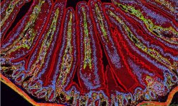 La interacción entre la composición genética de un individuo y la microbiota residente en el intestino contribuyen a la patogénesis de la enfermedad inflamatoria del intestino. Imagen: Mark Ellisman and Tom Deerinck, National Center for Microscopy and Imaging Research.