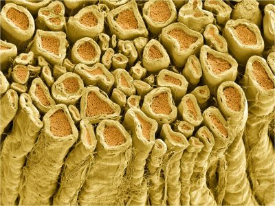 En la imagen, axones de rata mielinizados. Imagen: Tom Deerinck and Mark Ellisman, National Center for Microscopy and Imaging Research.