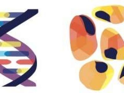 Four Subtypes of Gastric Cancer
