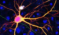 Neurona cuyo ADN ha sido modificado utilizando la tecnología SATI. Imagen: Instituto Salk.