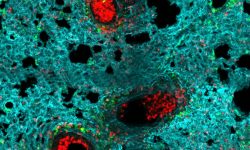 Neutrófilos (rojo) se acumulan en los alveolos de un pulmón infectado con gripe Iván Ballesteros CNIC.