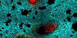 Neutrófilos (rojo) se acumulan en los alveolos de un pulmón infectado con gripe Iván Ballesteros CNIC.