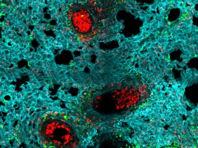 Neutrófilos (rojo) se acumulan en los alveolos de un pulmón infectado con gripe Iván Ballesteros CNIC.