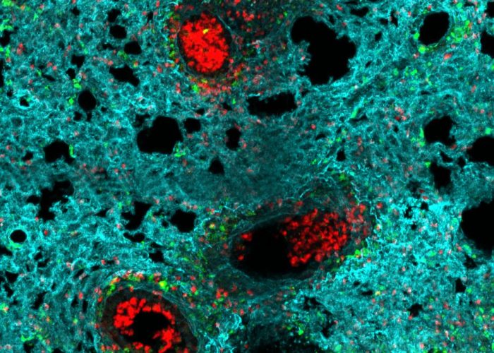 Neutrófilos (rojo) se acumulan en los alveolos de un pulmón infectado con gripe Iván Ballesteros CNIC.