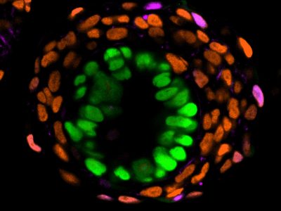 Embrioide de 4 días obtenido en el laboratorio de Magdalena Zernicka-Goetz con estructuras similares a los embriones: un dominio interno similar al epiblasto (del que derivará el embrión) marcado en verde, rodeado de células de tipo hipoblasto (que dará lugar al saco vitelino) marcadas en naranja y células similares a las del trofoblasto (precursor de los tejidos extraembrionarios) marcadas en morado. Imagen: Universidad de Cambridge.