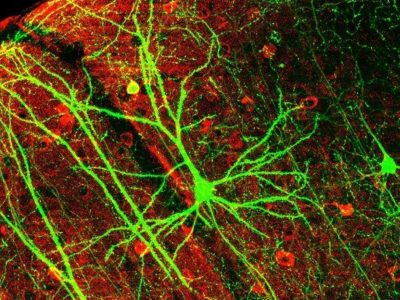 Neuronas. Imagen: Wei-Chung Allen Lee, Hayden Huang, Guoping Feng, Joshua R. Sanes, Emery N. Brown, Peter T. So, Elly Nedivi - Dynamic Remodeling of Dendritic Arbors in GABAergic Interneurons of Adult Visual Cortex. Lee WCA, Huang H, Feng G, Sanes JR, Brown EN, et al. PLoS Biology Vol. 4, No. 2, e29. doi:10.1371/journal.pbio.0040029, Figure 6f,  con modificaciones. Licensed under CC BY 2.5 via Wikimedia Commons - http://commons.wikimedia.org/wiki/File:PLoSBiol4.e126.Fig6fNeuron.jpg#mediaviewer/File:PLoSBiol4.e126.Fig6fNeuron.jpg