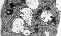 Plaqueta producida en el laboratorio a partir de la transdiferenciación de células de la piel y visualizada usando microscopía electrónica. El tamaño, la forma y el contenido de estas plaquetas generadas en el laboratorio son remarcablemente similares a las de las plaquetas reales. Imagen cortesía del CMR[B].