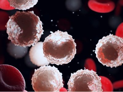 Trasladar el análisis de los 6 genes a una prueba podría permitir la clasificación de pacientes con leucemia en grupos con perspectivas de supervivencia muy distintas.