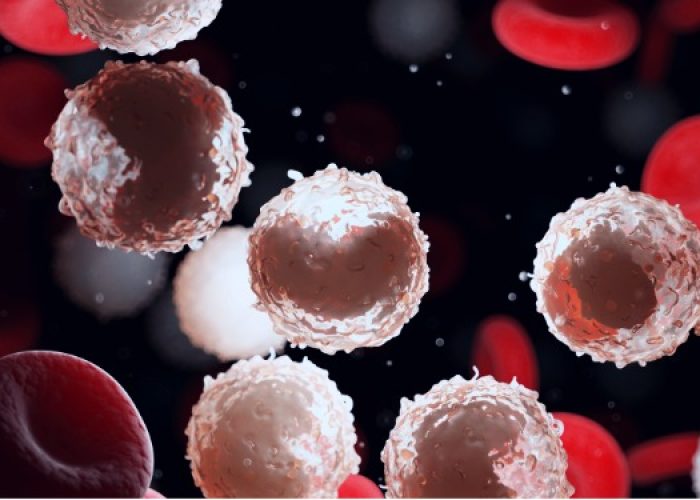 Trasladar el análisis de los 6 genes a una prueba podría permitir la clasificación de pacientes con leucemia en grupos con perspectivas de supervivencia muy distintas.