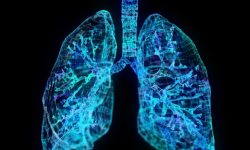 Ciertas partículas contaminantes del aire pueden inducir una respuesta inflamatoria que favorece la proliferación de células pulmonares con mutaciones de riesgo para el cáncer. Imagen: canva.