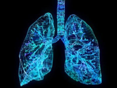 Ciertas partículas contaminantes del aire pueden inducir una respuesta inflamatoria que favorece la proliferación de células pulmonares con mutaciones de riesgo para el cáncer. Imagen: canva.