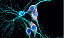 Proteína Rbfox en el citoplasma de la célula. Imagen: laboratorio de Kelsey Martin, director del trabajo.