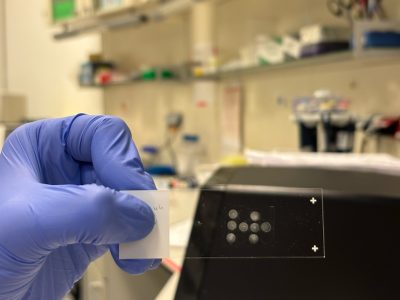 STAMP una técnica de análisis de células individuales muy prometedor y más rápida