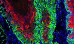 Sección de un tumor de piel en ratón. Las células que regeneran el tumor o las células madre están teñidas en verde, en rojo se ven las células más diferenciadas del tumor. Y en azúl están teñidos todos los nucleos celulares. Imagen cortesía de Sandra Blanco, Universidad de Cambridge.