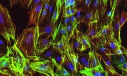 Células vasculares derivadas de células madre pluripotentes. Imagen:  Baldwin lab/Scripps Research.