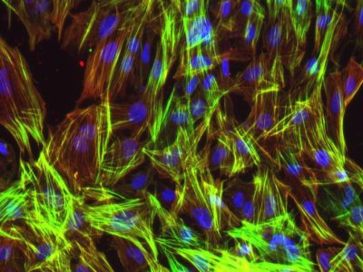 Células vasculares derivadas de células madre pluripotentes. Imagen:  Baldwin lab/Scripps Research.