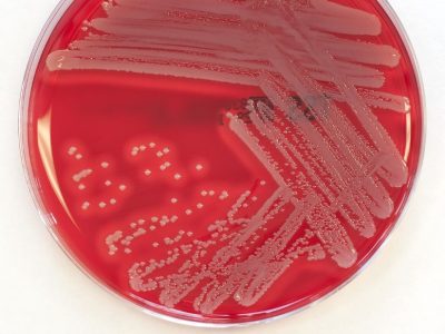 Staphylococcus aureus es la bacteria estafilococo más común