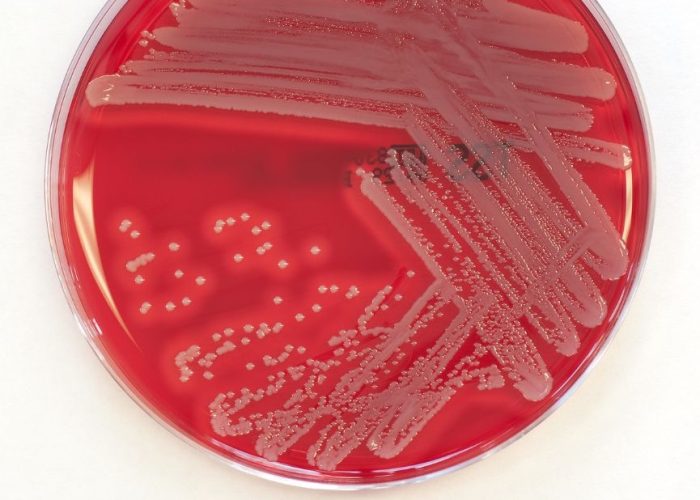 Staphylococcus aureus es la bacteria estafilococo más común